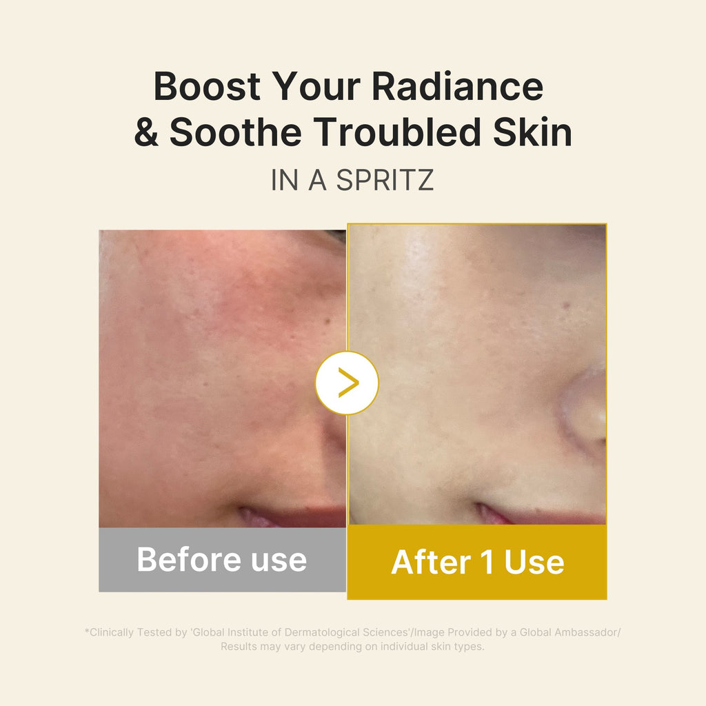 Kojic Acid Turmeric Vitamin Gold Jelly Mist Sérum